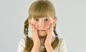 Dermatitis bei Kindern: 10 Tipps zur Bekämpfung von Dermatitis bei Kindern